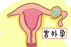 高龄女性做试管如何提升卵巢功能，三孩政策后年龄对试管成功率影响大吗