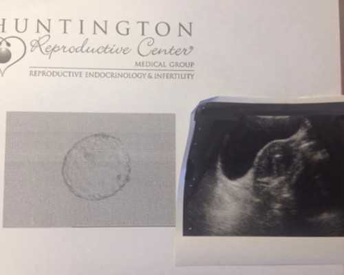 国内供卵要等多久才能移植,基本营养素*括哪些（基本营养素*括哪六大类）