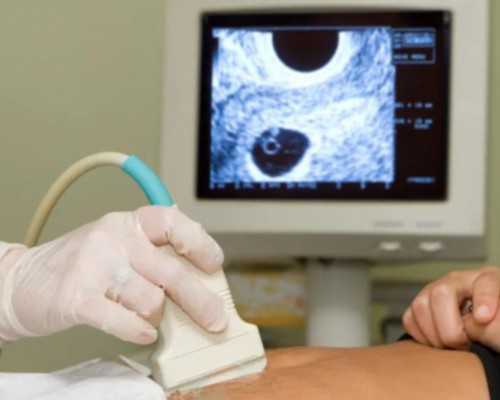 *市妇幼保健医院做第二代试管婴儿鲜胚移植胚胎 期待好消息 代怀试管多少钱