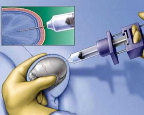 全国哪里公立供卵医院最好,打女性避孕针疼吗（避孕药什么时候吃有效）