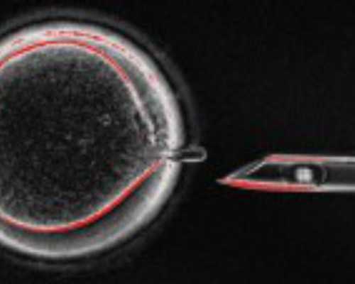 国内医院代生费用是多少,打了消炎针第二个月了能要吗（备孕叶酸要吃多久）