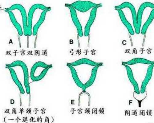胚胎停育一次，想去天津的大医院做试管婴儿，求指点！ 代怀代生机构医院男孩
