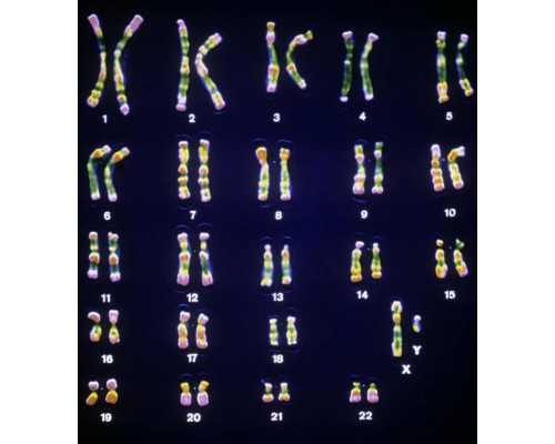 国内正规供卵机构需要多少钱,糖类抗原ca125偏高原因：炎症和肿瘤都是罪恶之源